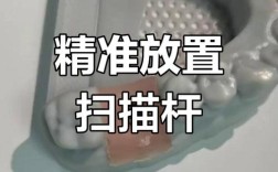 种植牙植入分析杆如何辅助精准种植？