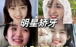 哪些明星悄悄矫正过牙齿？