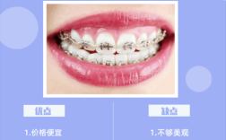 重庆矫正牙齿哪家好？从资质、口碑等方面怎么选机构？