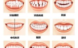 矫正牙齿牙缝示意图能解答牙缝哪些疑问？