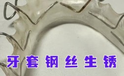 矫正牙齿的记忆钢丝