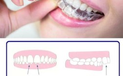 正畸和矫正有何不同？核心区别详解！