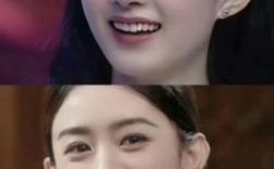 明星如何快速矫正牙齿？背后有哪些高效方法？