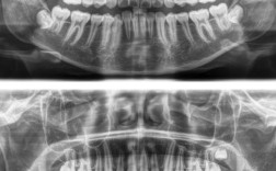 正畸侧位片是什么？为何正畸诊断离不开它？如何解读？