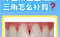 底面角可以正畸吗