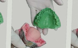 正畸印模制取为何关键？步骤要点与临床应用解析