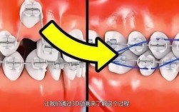 哪里有正规的3D正畸排牙软件？求推荐靠谱的获取渠道和方式？