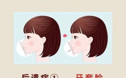 矫正牙齿能不戴牙套吗