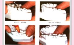 牙根延长术正畸法，效果与适用性如何？