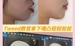 34岁了，矫正牙齿还来得及吗？