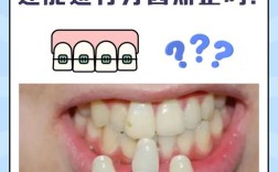 门牙黑，烤瓷牙和种植牙怎么选？