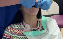 活动牙取模的具体方法步骤及注意事项有哪些？