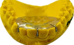 正畸平面导板制作需要准备哪些材料？具体操作步骤和注意事项有哪些？