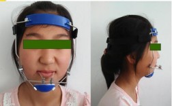 正畸面弓如何正确佩戴？操作步骤有哪些？