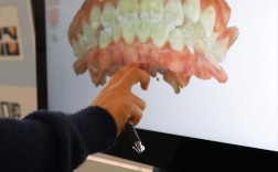 正夫口腔牙齿矫正效果如何？适合哪些人群做？优势有哪些？