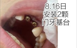 2颗牙可以种一棵吗？