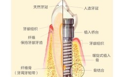 所有牙齿都能种牙吗？这些条件很重要