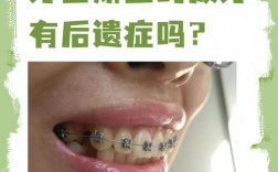 成人矫正为何需要拔牙？