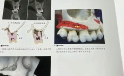 正畸微种植支抗钉究竟有哪些独特优势？相比传统支抗方式效果如何？安全性又该怎样保障？