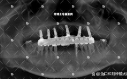 太仓牙博士种牙好吗？效果、价格、口碑、技术怎么样？