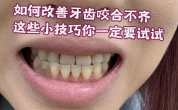 咬合不齐有哪些常见治疗方法？不同矫正方式适合哪些人群？效果如何及需要注意什么？