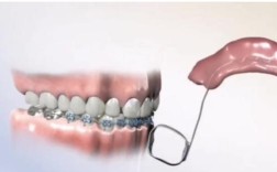 矫正牙齿的过程视频详细记录了哪些矫正步骤？