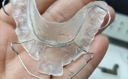 牙齿矫正器哪款好？不同需求怎么选？关键看这几点？