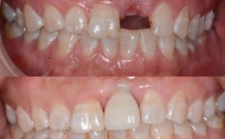 包头是昆区种牙