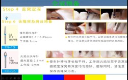 后牙备肩台方法如何规范操作？关键步骤有哪些？