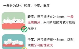 矫正牙齿时，拔磨牙是否可行？