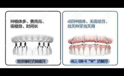 All-on-4种牙后使用有哪些关键注意事项？