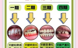 牙龈萎缩恢复土方法有效吗？哪些更靠谱？怎么用才见效？