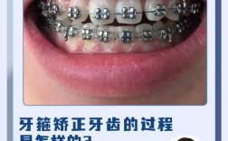 镶牙后可以做正畸吗