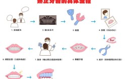 正畸期间过小牙如何修复？有哪些实用方法？