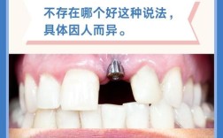 植牙好还是套牙好