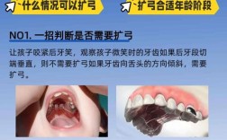 正畸扩弓有什么危害