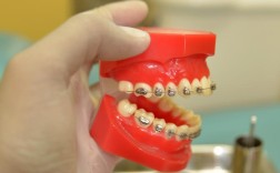 深圳成人牙齿矫正，效果怎么样？要多久？