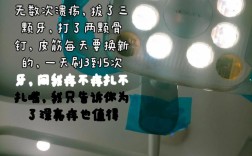 中山附属口腔医院正畸效果如何？不同错颌畸形适合哪些矫正技术？价格和周期大概是多少？