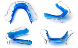 双弓丝正畸托槽