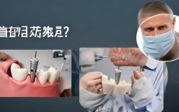 种植牙是否真的需要牙根？种植体与天然牙根的作用有何不同？