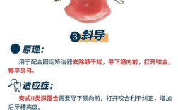 正畸牵引钩如何正确使用？操作步骤与注意事项有哪些？