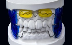 德国进口正畸托槽相比普通托槽效果真的更出色吗？