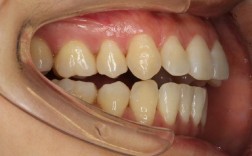 关节有问题能正畸么