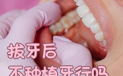 拔牙后，种牙是必须的吗？
