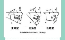 正畸研究生高角病例PPT研究重点与难点是什么？