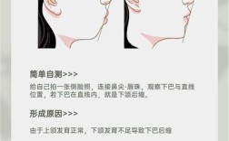 自己能改善反颌吗？有哪些实用方法可行？