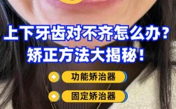 下排牙齿不齐能矫正吗？效果能维持多久？