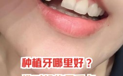 金华种牙哪里好？医院怎么选？求推荐靠谱的机构？