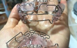 兜齿矫正有哪些方法？