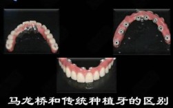 国内种牙哪里最好？医院技术与口碑怎么选？